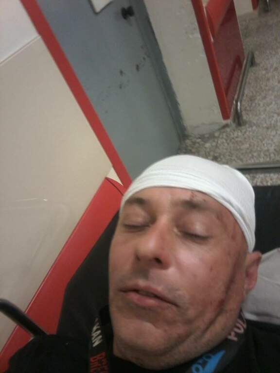 Гореща тема във Фейсбук: Васил Христов е нападнат и зверски бит от тълпа цигани | Novinite.EU image 1